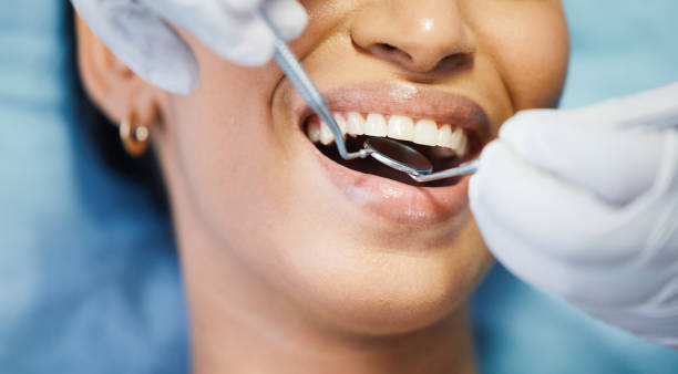 Best Lost Filling or Crown Replacement in Bayside, WI