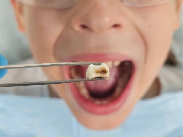 Best Emergency Denture Repair in Bayside, WI